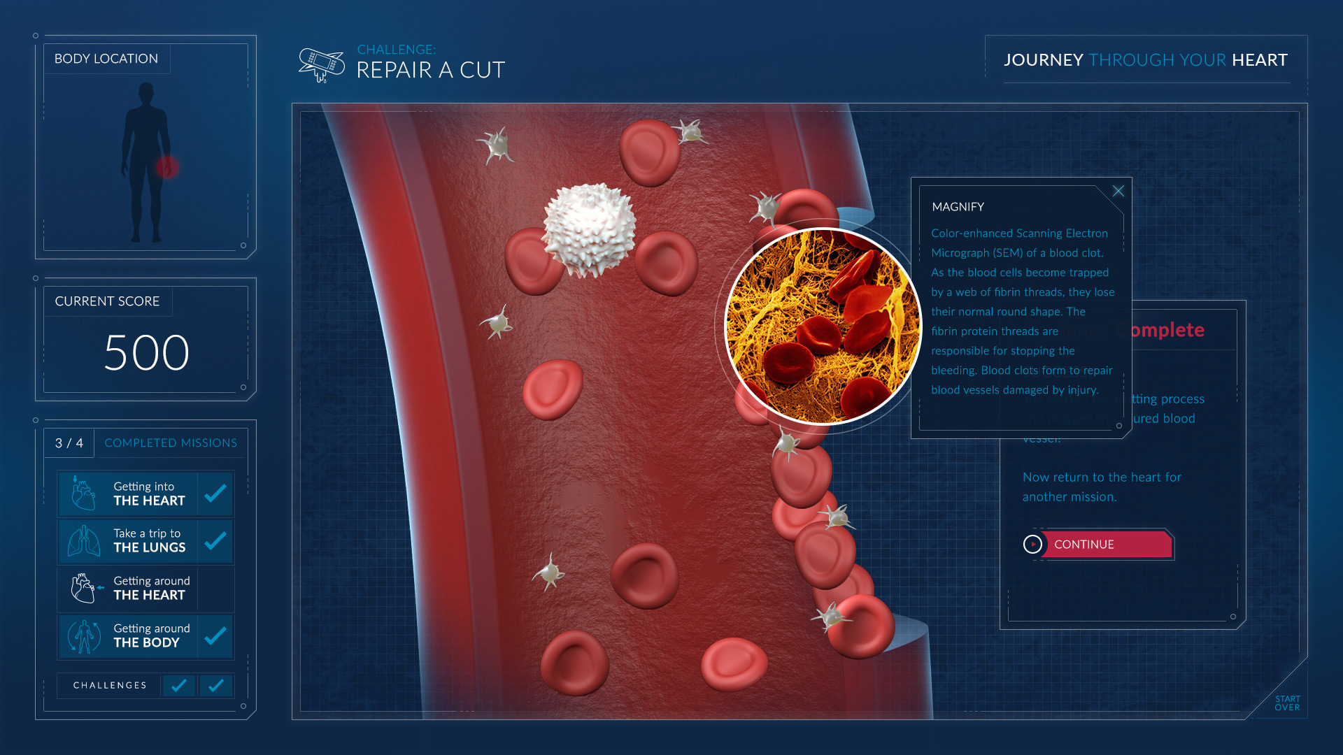 Heart_Hotspot-Cut2